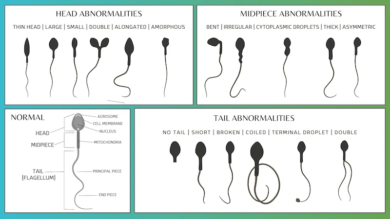 sperm morphology diagram from cryobank america