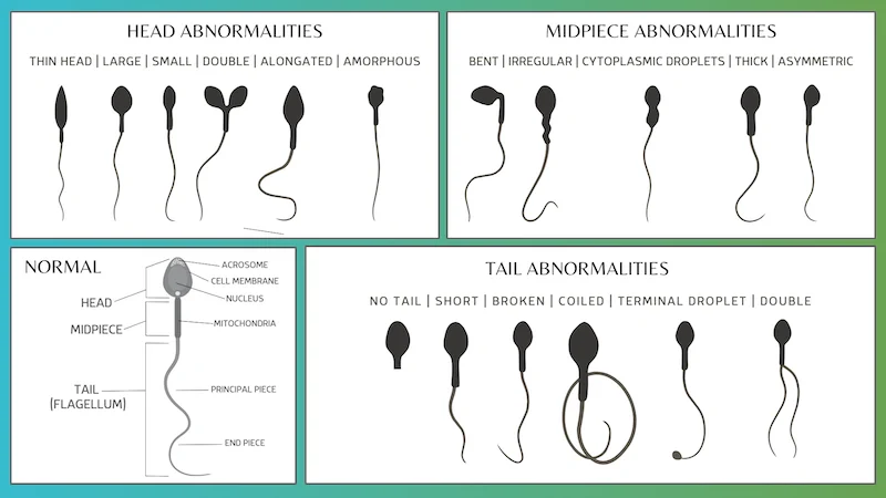 Standard Operating Procedure (SOP) For Seminal Fluid Analysis » Medlabhq