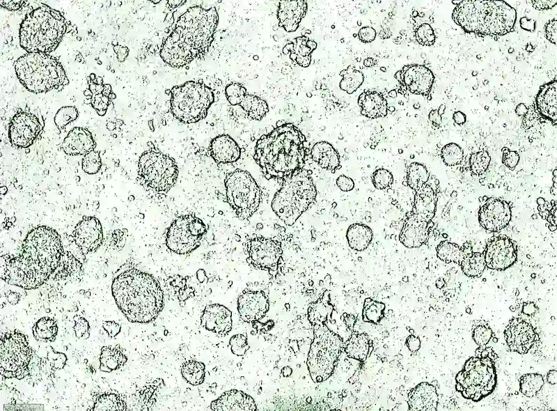 Stem Cell Therapy for Embryo and Sperm Cell Health