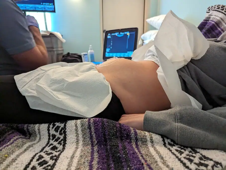 kristin exton's pregnancy journey