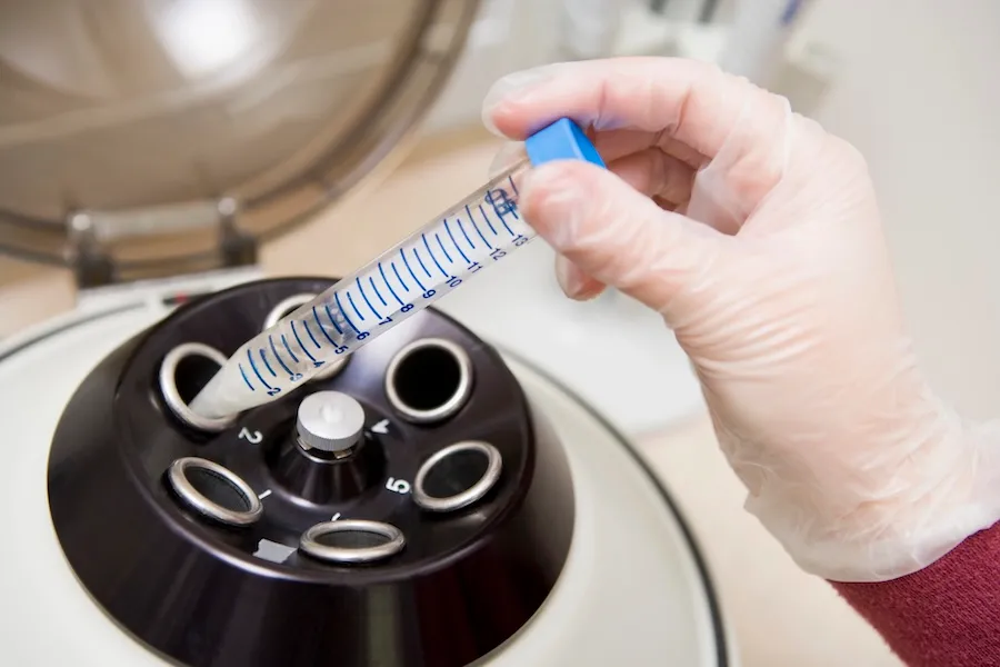 sperm mot explained